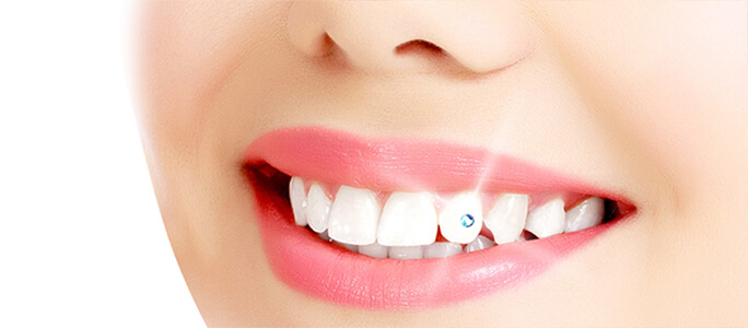 Tooth Jewellery