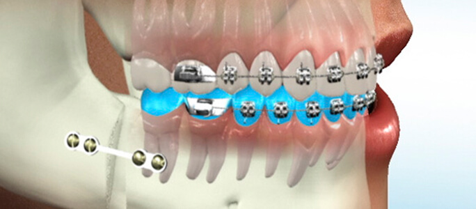 Oral and Maxillofacial